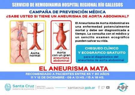 Campaña gratuita de detección de Aneurisma de Aorta Abdominal