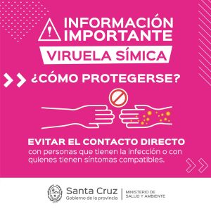 Confirman como positivo caso de Viruela Símica en Santa Cruz